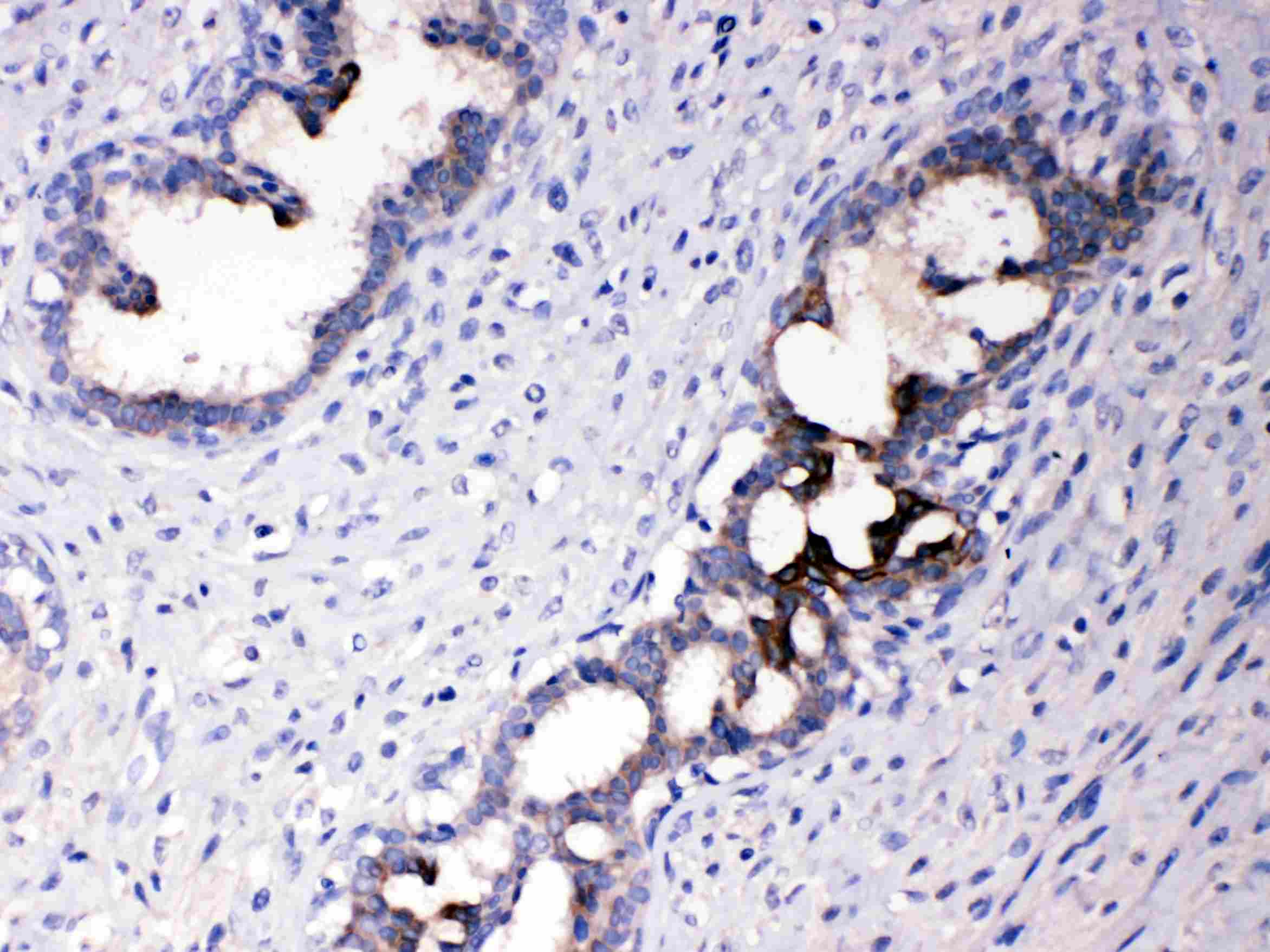 Polyclonal Rabbit anti-Human ATF6 Antibody (IHC, WB)