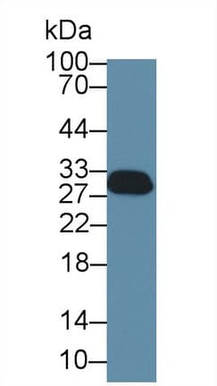 SFN / Stratifin / 14-3-3 Sigma Antibody (aa1-248)