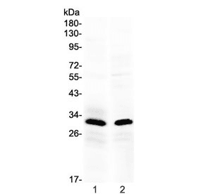 IL-1B / IL-1 Beta Antibody