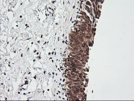 Monoclonal Mouse anti-Human RIOK2 Antibody (clone OTI3E11, IHC, IF, WB)