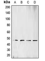 BCKDK Antibody (N-Terminus)