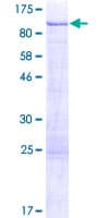 Human PRKCD / PKC-Delta Protein (Recombinant GST)