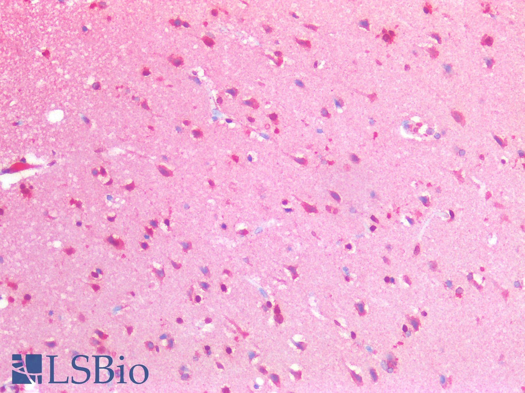 IHC-plus™ Monoclonal Mouse anti-Human SGTA / SGT Antibody (clone AT19E8, IHC, IF, WB)