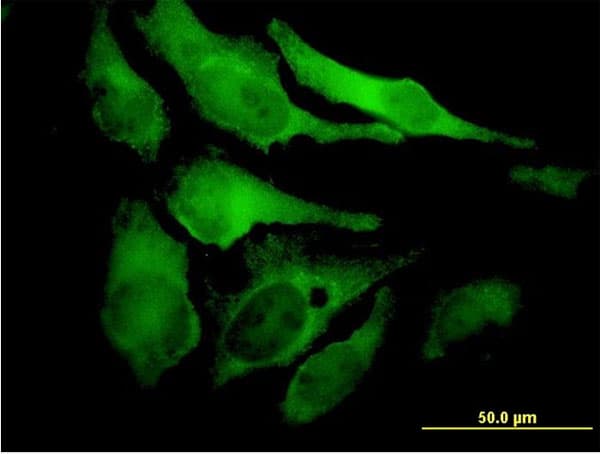 EYA2 Antibody (clone 2F8)