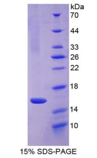 Rat LGALS9 / Galectin 9 Protein (Recombinant His)