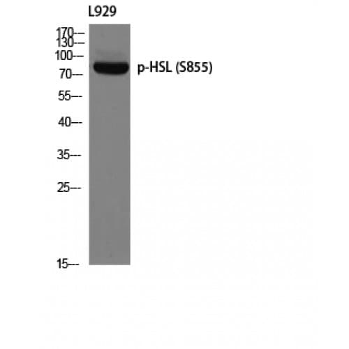 LIPE / HSL Antibody (490-570 aa)