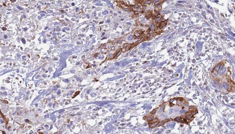 TGFA / TGF Alpha Antibody