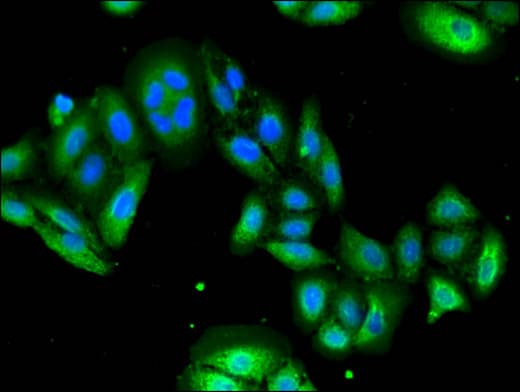 Polyclonal Rabbit anti-Human USP6 / HRP1 Antibody (IHC, IF, WB)