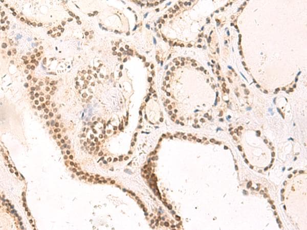 TEAD3 Antibody