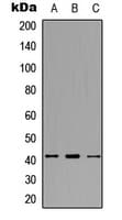 Polyclonal Rabbit anti-Human SDCCAG8 Antibody (C-Terminus, IHC, WB)
