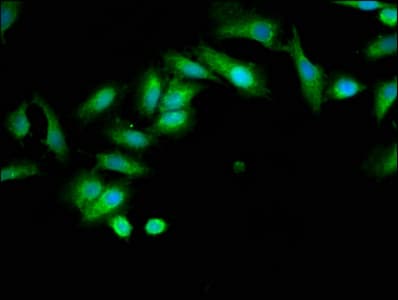Polyclonal Rabbit anti-Human INPP5B Antibody (IHC, IF)