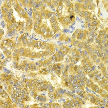 DLD / Diaphorase / E3 Antibody