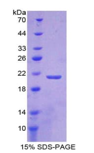 Rat LAMB2 / Laminin Beta 2 Protein (Recombinant His-T7)