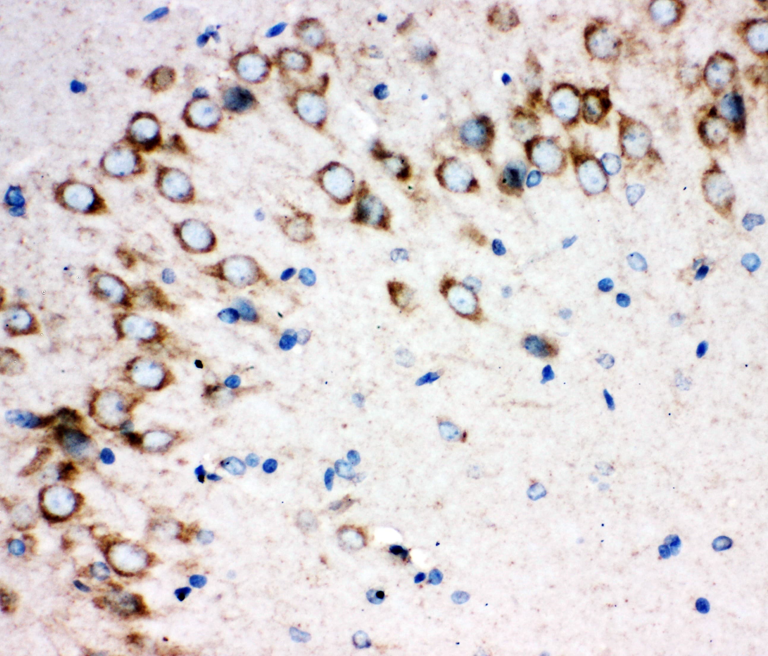 Polyclonal Rabbit anti-Human SHH / Sonic Hedgehog Antibody (aa203-218, IHC, WB)