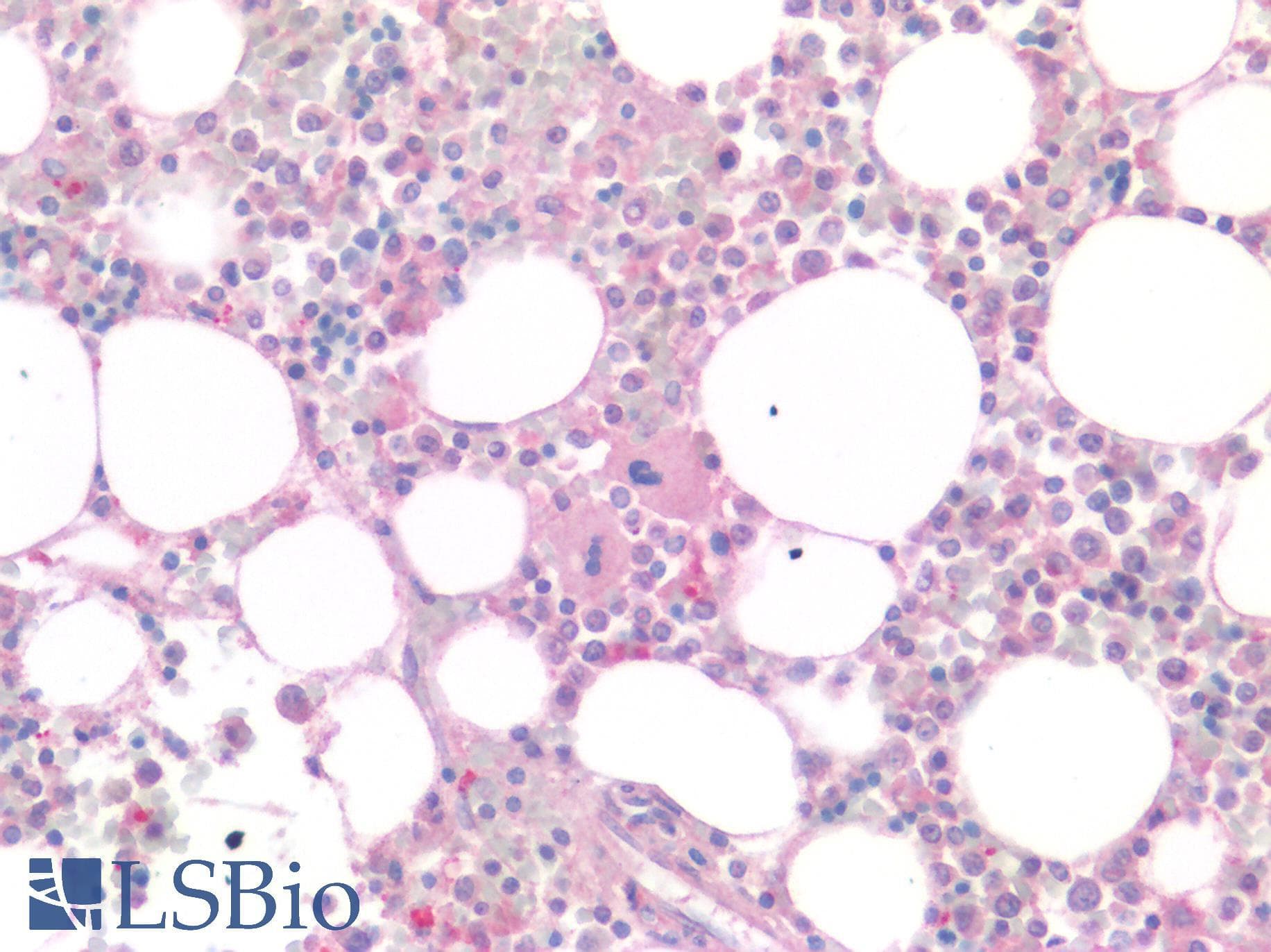 IHC-plus™ MSLN / Mesothelin Antibody
