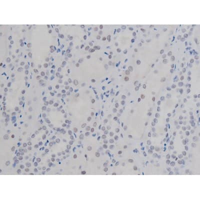 NPM1 / NPM / Nucleophosmin Antibody (phospho-Thr199)