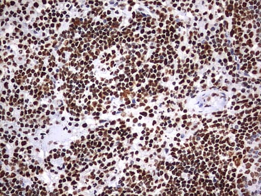Monoclonal Mouse anti-Human HNRPM / HNRNPM Antibody (clone OTI1F6, aa1-261, IHC, WB)