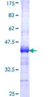 Human Acetyl-CoA Carboxylase / ACC Protein (Recombinant GST, N-terminus)