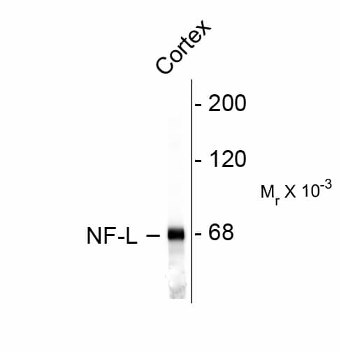 NF-L / NEFL Antibody