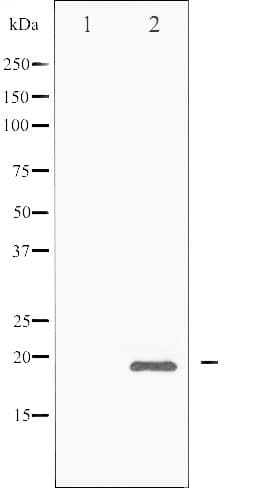 DDIT3 / CHOP Antibody (phospho-Ser30)