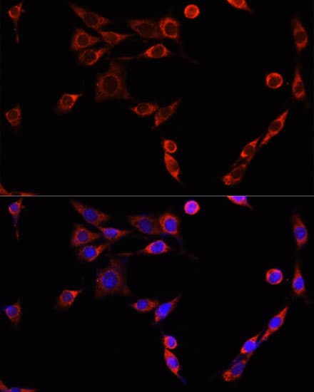 Polyclonal Rabbit anti-Human BAX Antibody (IHC, IF, WB)