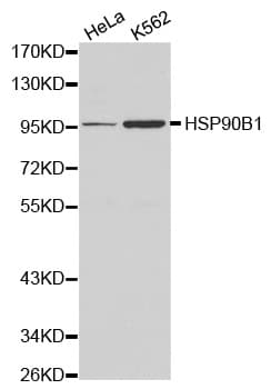 HSP90B1 / GP96 / GRP94 Antibody