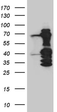 ASH2L / ASH2 Antibody (aa347-628, clone OTI7D11)