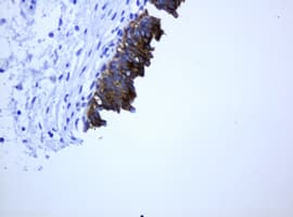 Monoclonal Mouse anti-Human ABCB1 / MDR1 / P Glycoprotein Antibody (clone OTI5B3, IHC)