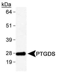 IHC-plus™ Prostaglandin D Synthase Antibody (aa1-50)