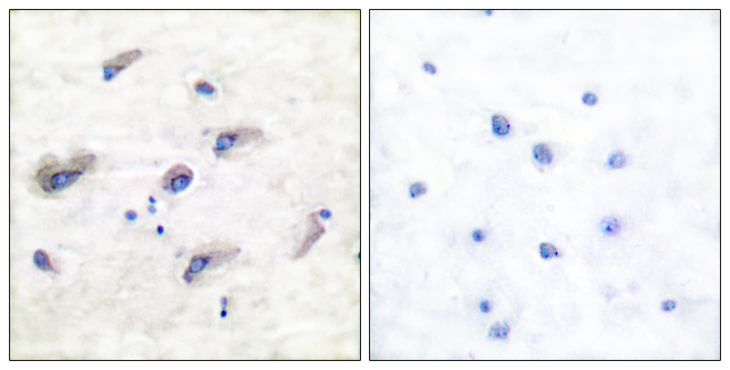 Polyclonal Rabbit anti-Human MAPT / Tau Antibody (phospho-Ser356, IHC, WB)