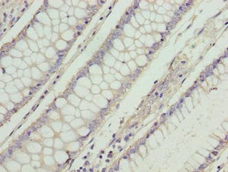 Polyclonal Rabbit anti-Human RD3 Antibody (IHC, WB)