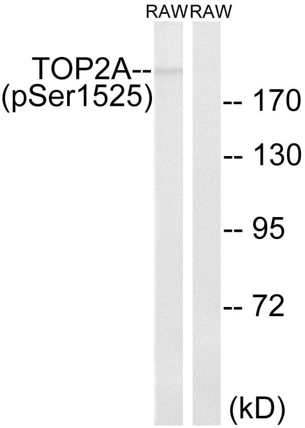 Polyclonal Rabbit anti-Human TOP2A / Topoisomerase II Alpha Antibody (phospho-Ser1525, IHC, WB)