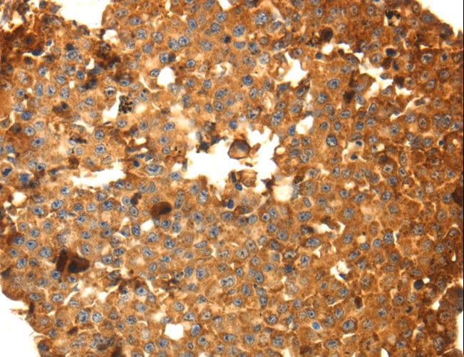 DRD5 / Dopamine Receptor D5 Antibody