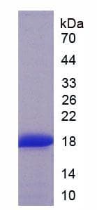 Human TNNT3 Protein (Recombinant His)