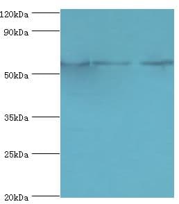 Polyclonal Rabbit anti-Human PPP3CC / CALNA3 Antibody (aa373-512, IHC, WB)