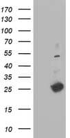Thymidylate Kinase Antibody (clone OTI1D2)