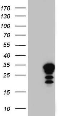 LGALS3 / Galectin 3 Antibody (clone OTI9C7)