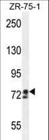 Polyclonal Rabbit anti-Human DCLK / DCLK1 Antibody (aa690-720, WB)