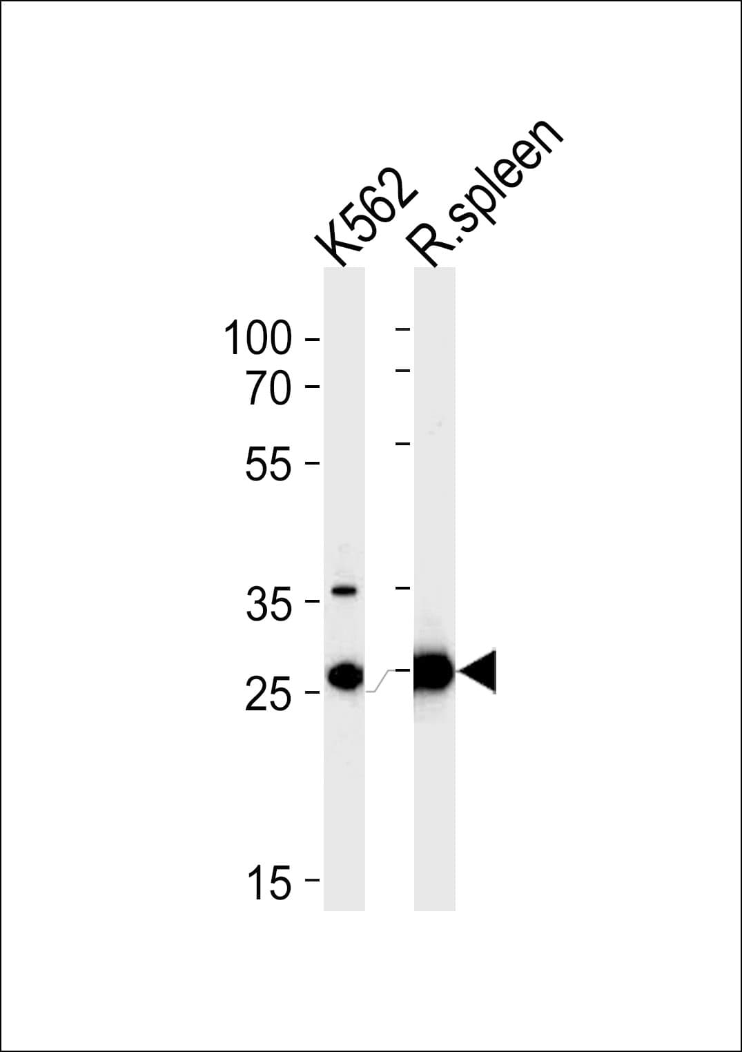 IHC-plus™ SLC25A37 / Mitoferrin Antibody (aa309-338)