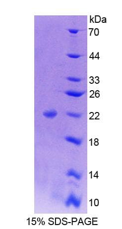 Human NFIA / Nuclear Factor 1 Protein (Recombinant His-T7)