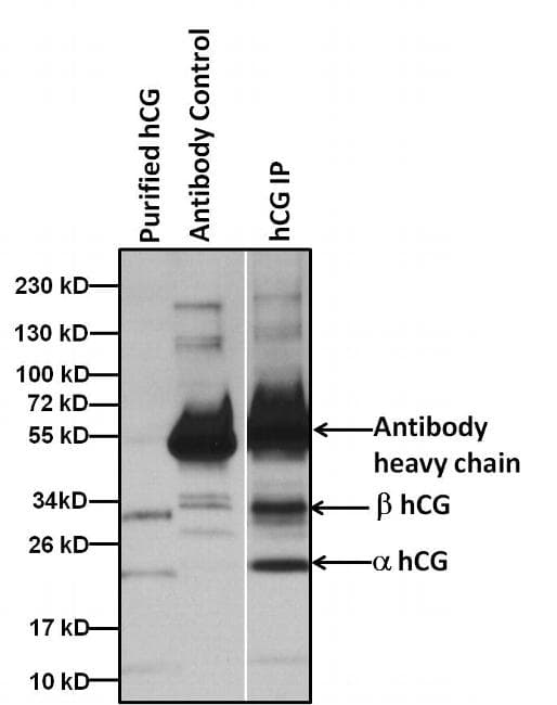 hCG / Chorionic Gonadotropin Antibody (clone SC1)