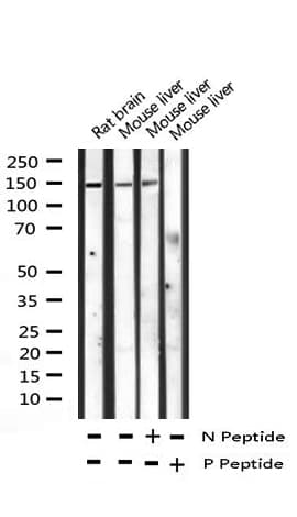 PLCG1 Antibody (phospho-Tyr783)