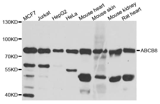 ABCB8 Antibody