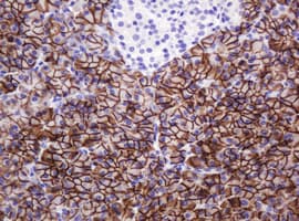 CA12 / Carbonic Anhydrase XII Antibody (clone OTI4G3)