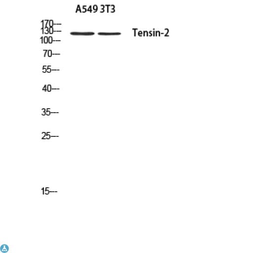 Polyclonal Rabbit anti-Human TNS2 / TENC1 Antibody (WB)
