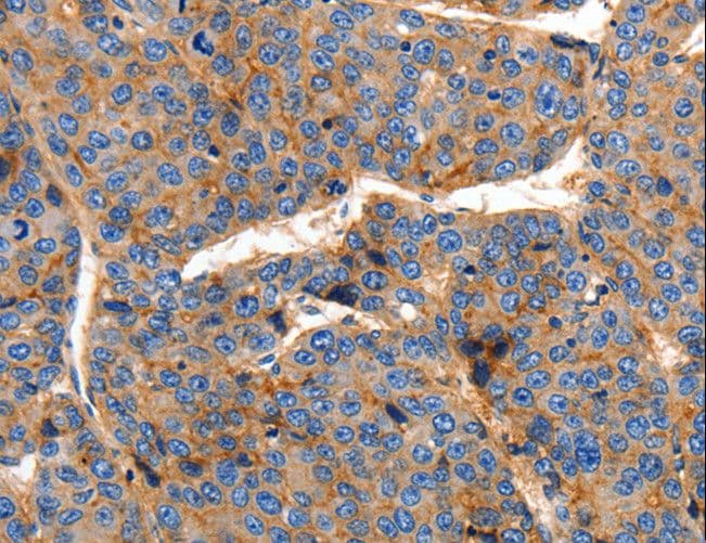 CLDN1 / Claudin 1 Antibody