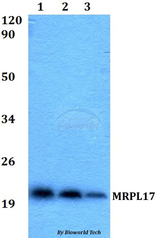 Polyclonal Rabbit anti-Human MRPL17 Antibody (WB)