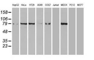 Monoclonal Mouse anti-Human CTNNB1 / Beta Catenin Antibody (clone OTI2H3, WB)