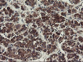 UBE2J1 Antibody (clone OTI1F6)