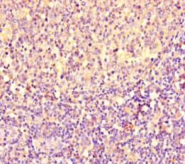 PGP Antibody